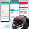 VIBE CHIC SMARTWATCH EKG DAMSKI CIŚNIENIOMIERZ POMIAR GLUKOZY AMOLED ROZMOWY