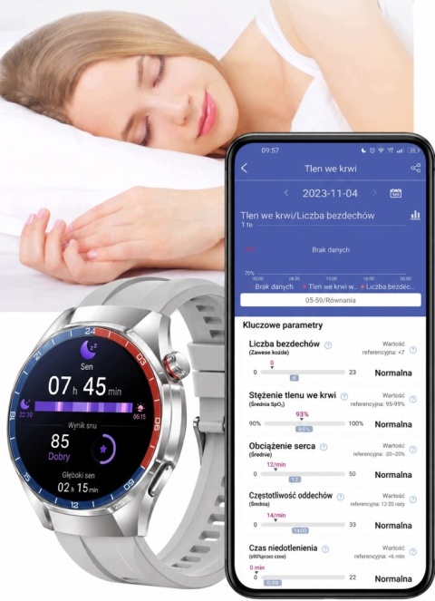 VIBE CHIC SMARTWATCH EKG DAMSKI CIŚNIENIOMIERZ POMIAR GLUKOZY AMOLED ROZMOWY