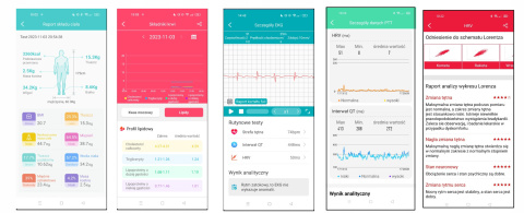 Zegarek Smartwatch Damski EKG Glukoza HRV BMI AMOLED CIŚNIENIOMIERZ ROZMOWY HRV2025 Zegarek Smartwatch Damski EKG Glukoza HRV BMI AMOLED CIŚNIENIOMIERZ ROZMOWY HRV2025